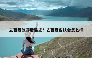 去西藏旅游后起皮？去西藏皮肤会怎么样